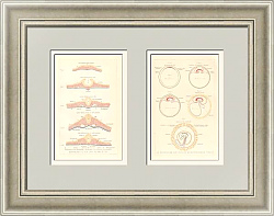 "Эмбриология" - редкие антикварные литографии