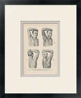 "Мышцы руки и плеча человека" - антикварная гравюра